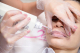 Laserowe usuwanie makijażu permanentnego ust za pomocą lasera NDYAG Boroń Permanentne Piękno